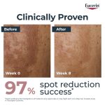 Eucerin Anti-Pigment Dual Face Serum for Pigmentation 30ml - Image 3